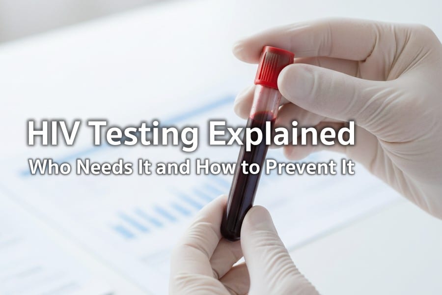 HIV Testing: Who Should Test and When